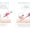Adva  IV Cannula - Image 2